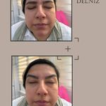 پزشک زیبایی ،پوست ،سوزنی ،اطفال حقایق