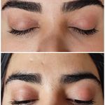 اصلاح تخصصی وترمیمی ابروی فرزانه