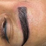 کاشت ابرو و موی باران