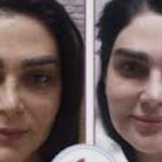کلینیک زیبایی الماس کاملا اقساطی