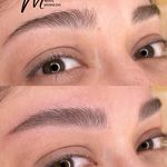 میکروبلیدینگ و شیدینگ مینا حسینی