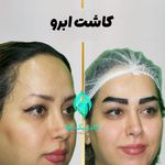 کلینیک تخصصی پوست و کاشت مو آوا