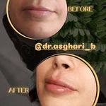 مطب زیبایی دکتر سیده زهرا حسینی