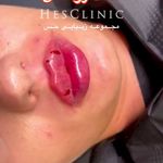 مرکز تخصصی زیبایی و پزشکی حس