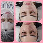 کلینیک فیشیال و پاکسازی پوست نازنین