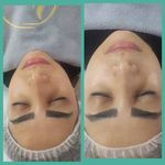 کلینیک فیشیال و پاکسازی پوست نازنین