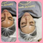 کلینیک فیشیال و پاکسازی پوست نازنین