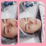 کلینیک فیشیال و پاکسازی پوست نازنین