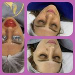 کلینیک فیشیال و پاکسازی پوست نازنین