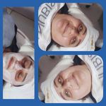 کلینیک فیشیال و پاکسازی پوست نازنین