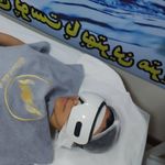 کلینیک فیشیال و پاکسازی پوست نازنین