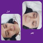 کلینیک فیشیال و پاکسازی پوست نازنین