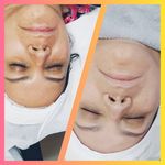 کلینیک فیشیال و پاکسازی پوست نازنین