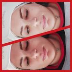 کلینیک فیشیال و پاکسازی پوست نازنین