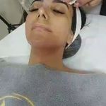 کلینیک فیشیال و پاکسازی پوست نازنین