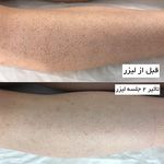 مرکز لیزر وکلینیک زیبایی پایون(بانوان)