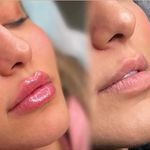 مطب زیبایی خانم محمدرضایی پوست ومو