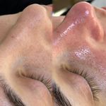 فیشیال / خدمات پوست / سالن زیبایی