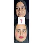 کلینیک زیبایی نامیرا