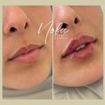 کلینیک زیبایی و لیزر مو زائد نوبا
