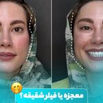 کلینیک زیبایی لیان