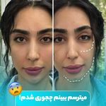 کلینیک زیبایی لیان