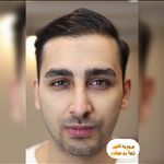 کلینیک زیبایی پوست و لیزر آلن