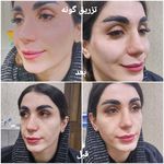 کلینیک زیبایی و لیزر مو گندم شرق تهران