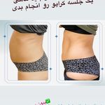 کلینیک پوست و زیبایی ولاغری تاج عظیمیه