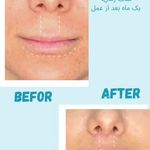 کلینیک زیبایی آوا بیوتی