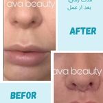 کلینیک زیبایی آوا بیوتی