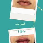 کلینیک زیبایی آوا بیوتی