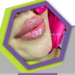 کلینیک زیبایی آوا بیوتی