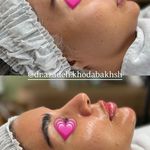 مطب زیبایی آرا