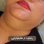 كلينيك پوست و مو و ليزر لادن