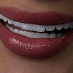 مرکز ایمپلنت و زیبایی دکتر روشن طلب