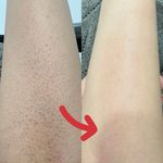 خدمات تخصصی پوست (فیشیالیست رویا صالحی)