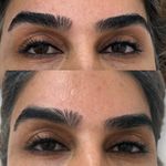 اصلاح تخصصی ابرو