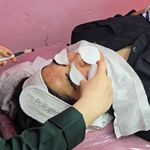 خدمات تخصصی پوست اِلی