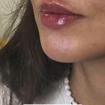 کلینیک لاغری، لیزر، پوست، مو لَوی