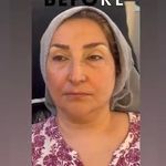 سالن زیبایی تخصصی چیکا (آوازه هنر سابق)