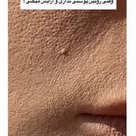 رزینا _محصولات مراقبتی و جوانسازی