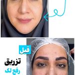 کلینیک تخصصی پوست و زیبایی ملینا