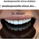دکتر حسین اکبری دندانپزشک (زیبایی )