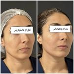 کلینیک پوست و مو بلانژ