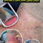 کلینیک تخصصی پوست و مو دکتر درخشان
