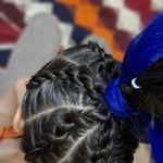 خدمات تخصصی بافت موی دنیز