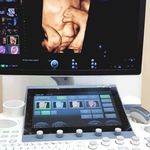 رادیولوژی سونوگرافی دکترشماعی