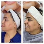 کلینیک زیبایی پوست و مو موژا مظفری
