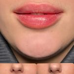 درمان زخم و خدمات زیبایی بهزاد قلی ها